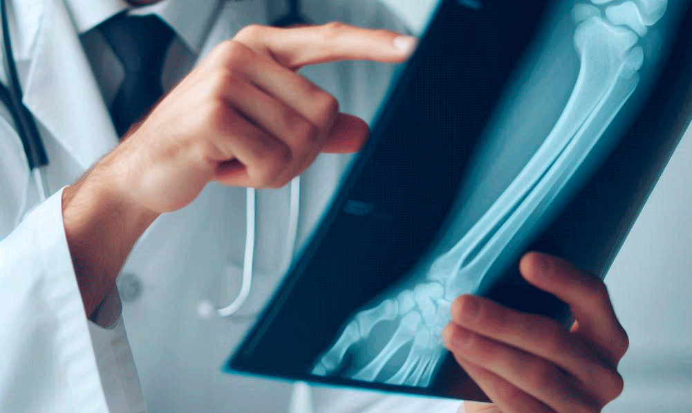 Traumatólogo viendo radiografía de brazo Traumatólogo viendo radiografía de brazo